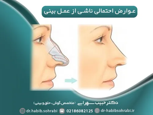 عوارض جراحی بینی