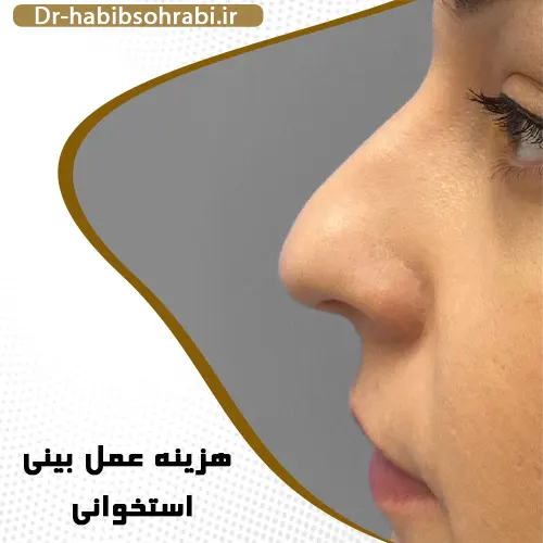 هزینه عمل بینی استخوانی 1402