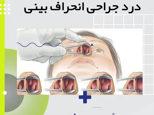 میزان درد عمل بینی انحرافی