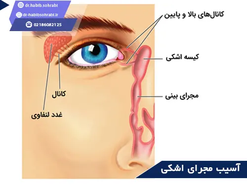 عوارض عمل بینی(آسیب مجرای اشکی)
