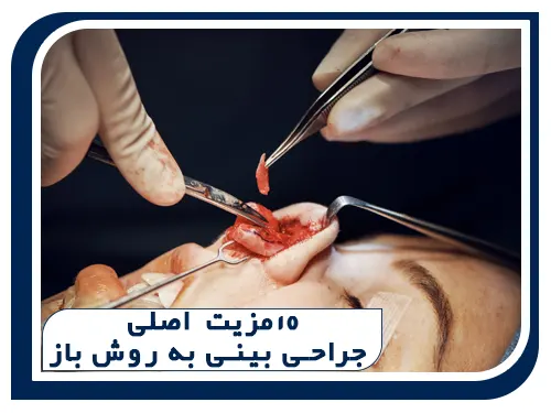 مزیتهای اصلی جراحی بینی به روش باز