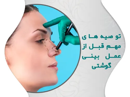 توصیه های کاربردی قبل از جراحی بینی گوشتی