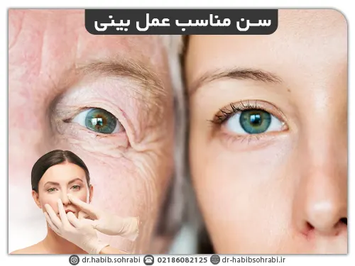 سن مناسب عمل بینی
