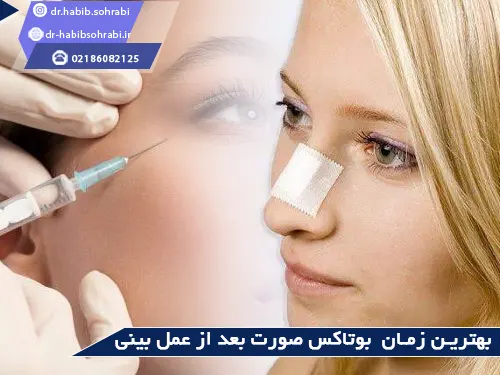 بهترین زمان بوتاکس صورت پس از جراحی بینی