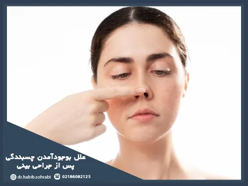 چسبندگی لبه‌های بینی به تیغه چگونه بوجود می‌آید؟(چسبندگی بینی بعد از عمل