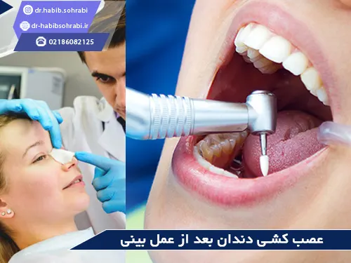 دندانپزشکی بعد از عمل بینی(عصب کشی)