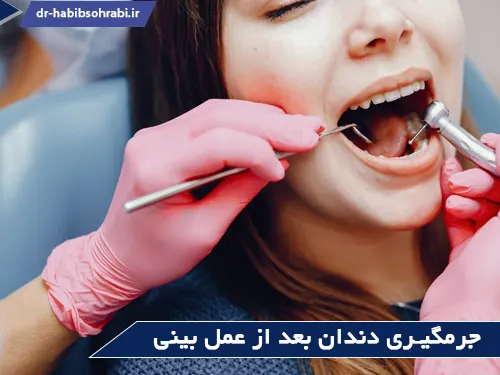 دندانپزشکی بعد از عمل بینی(جرمگیری)