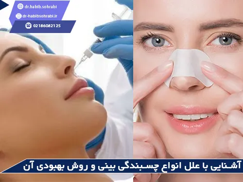 نحوه درمان چسبندگی بینی بعد از عمل