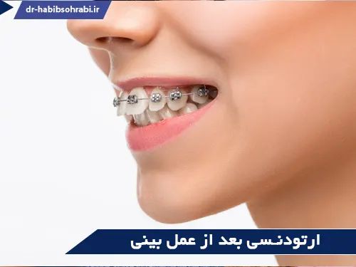 دندانپزشکی بعد از عمل بینی(ارتودنسی)