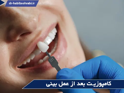 دندانپزشکی بعد از عمل بینی(کامپوزیت)