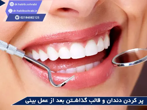 دندانپزشکی بعد از عمل بینی(پر کردن)