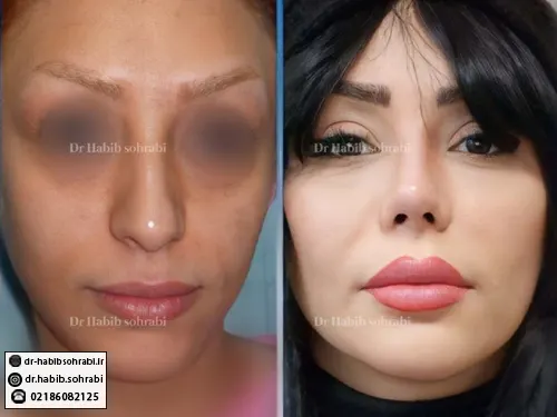 بینی عروسکی فانتزی