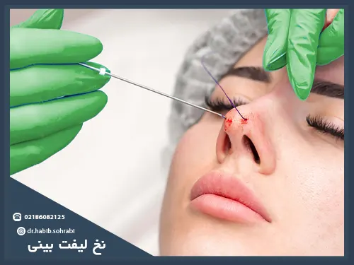 کوچک کردن بینی بدون عمل جراحی(نخ لیفت)