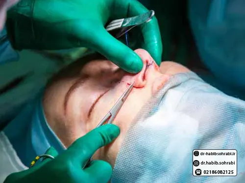 درمان شکستگی بینی با عمل جراحی