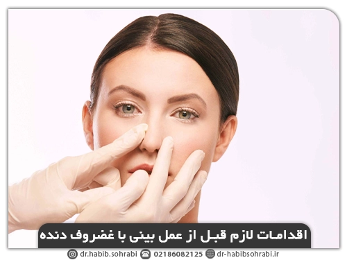 اقدامات لازم قبل از عمل بینی با غضروف دنده