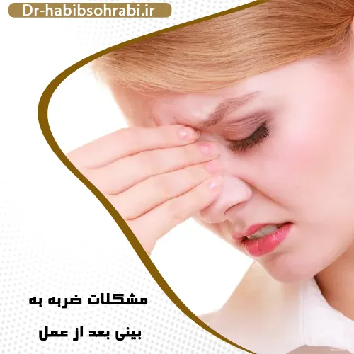 ضربه به بینی عمل شده