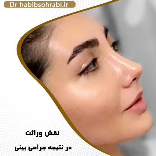 نقش ژنتیک در شکل و ساختار بینی